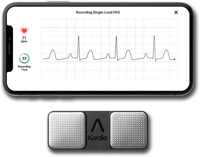KardiaMobile 1-Lead Personal EKG Monitor – Record at Home – Detects AFib & Irregular Arrhythmias – Easy Results in 30 Seconds – Works w/Most Smartphones - FSA/HSA Eligible
