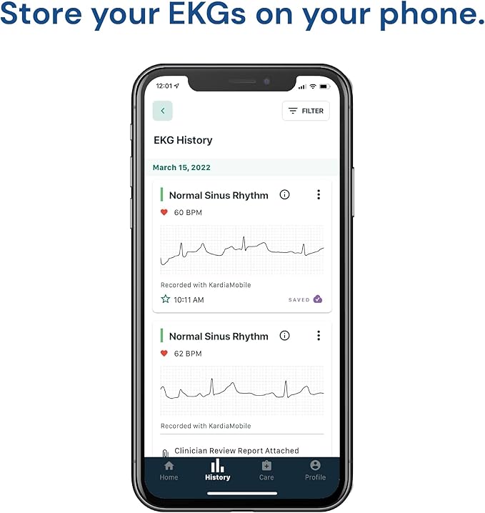 KardiaMobile 1-Lead Personal EKG Monitor – Record at Home – Detects AFib & Irregular Arrhythmias – Easy Results in 30 Seconds – Works w/Most Smartphones - FSA/HSA Eligible